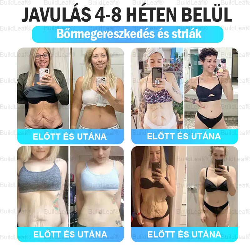 Buildleaf® Tirzepatide Nano Mikrotűs Párna Kollagénnel és Matrixyl 3000-al | Célzott megoldás elhízásra, laza bőrre, magas vérnyomásra, cukorbetegségre és más egészségügyi problémákra