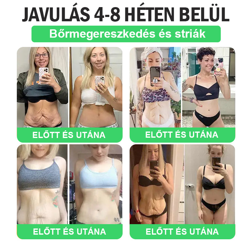 🎉 Ne hagyd ki! Csak 5 doboz van hátra! 🕔 Most extra 50% kedvezményt kínálunk! 💥 Tedd meg az első lépést az egészséges életmód felé. Ha most nem döntesz, csak jövőre kapod meg a következő esélyt!