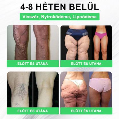 🎉 Ne hagyd ki! Csak 5 doboz van hátra! 🕔 Most extra 50% kedvezményt kínálunk! 💥 Tedd meg az első lépést az egészséges életmód felé. Ha most nem döntesz, csak jövőre kapod meg a következő esélyt!