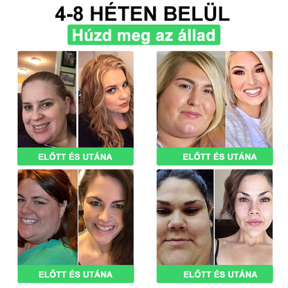 🎉 Ne hagyd ki! Csak 5 doboz van hátra! 🕔 Most extra 50% kedvezményt kínálunk! 💥 Tedd meg az első lépést az egészséges életmód felé. Ha most nem döntesz, csak jövőre kapod meg a következő esélyt!