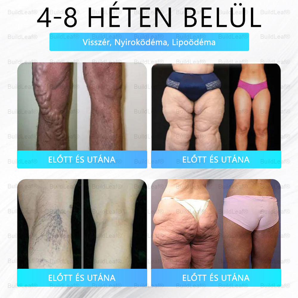🎁 Már csak 5 doboz maradt! Plusz 50% kedvezményt adunk! Légy fitt és egészséges. Fogyj le most, és csak jövőre lesz másik esélyed.